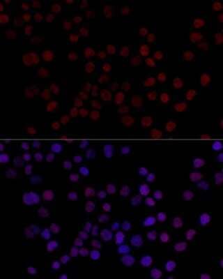 Immunocytochemistry/Immunofluorescence: hnRNP L Antibody [NBP3-03641] - Analysis of 293T cells using hnRNP L antibody at dilution of 1:100 (40x lens). Blue: DAPI for nuclear staining.