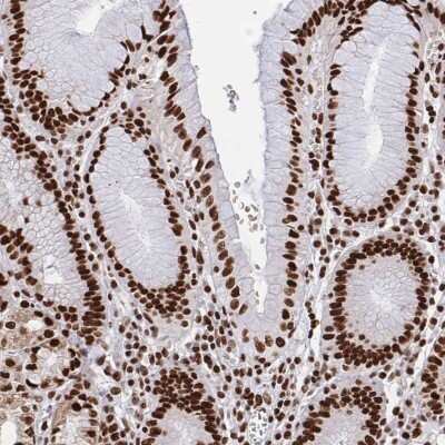 Immunohistochemistry-Paraffin: hnRNP L Antibody [NBP2-33627] - Staining of human stomach shows strong nuclear positivity in glandular cells.