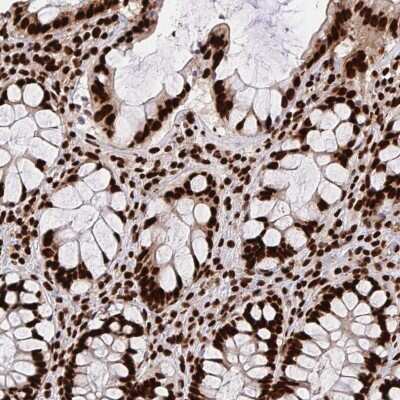 Immunohistochemistry-Paraffin: hnRNP L Antibody [NBP2-38675] - Staining of human rectum shows strong nuclear positivity in glandular cells.