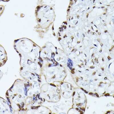 Immunohistochemistry-Paraffin: hnRNP L Antibody [NBP3-03640] - Immunohistochemistry of paraffin-embedded human placenta using hnRNP L antibody (NBP3-03640) at dilution of 1:100 (40x lens). Perform microwave antigen retrieval with 10 mM PBS buffer pH 7.2 before commencing with IHC staining protocol.