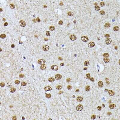 Immunohistochemistry-Paraffin: hnRNP L Antibody [NBP3-03640] - Immunohistochemistry of paraffin-embedded mouse brain using hnRNP L antibody (NBP3-03640) at dilution of 1:100 (40x lens). Perform microwave antigen retrieval with 10 mM PBS buffer pH 7.2 before commencing with IHC staining protocol.