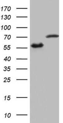 Adhesion Activation: hnRNP L Antibody (OTI2E4) [NBP2-45990] - HEK293T cells were transfected with the pCMV6-ENTRY control (Left lane) or pCMV6-ENTRY HNRNPL cDNA for 48 hrs and lysed. Equivalent amounts of cell lysates (5 ug per lane) were separated by SDS-PAGE and immunoblotted with anti-HNRNPL.