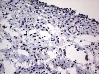 Immunohistochemistry: hnRNP L Antibody (OTI2E4) - Azide and BSA Free [NBP2-70908] - Analysis of Human bladder tissue. (Heat-induced epitope retrieval by 1 mM EDTA in 10mM Tris, pH8.5, 120C for 3min)