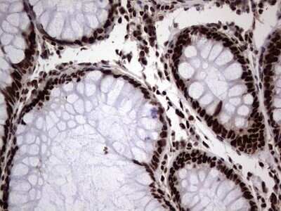 Immunohistochemistry: hnRNP L Antibody (OTI2E4) - Azide and BSA Free [NBP2-70908] - Analysis of Human colon tissue. (Heat-induced epitope retrieval by 1 mM EDTA in 10mM Tris, pH8.5, 120C for 3min)