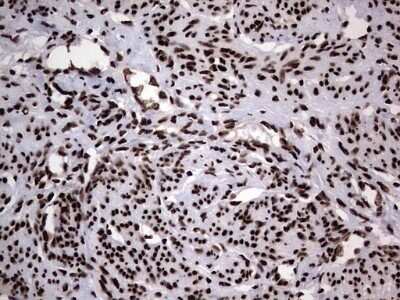 Immunohistochemistry: hnRNP L Antibody (OTI2E4) - Azide and BSA Free [NBP2-70908] - Analysis of Human endometrium tissue. (Heat-induced epitope retrieval by 1 mM EDTA in 10mM Tris, pH8.5, 120C for 3min)