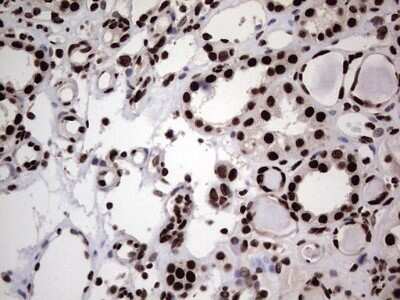 Immunohistochemistry: hnRNP L Antibody (OTI2E4) - Azide and BSA Free [NBP2-70908] - Analysis of Human Kidney tissue. (Heat-induced epitope retrieval by 1 mM EDTA in 10mM Tris, pH8.5, 120C for 3min)