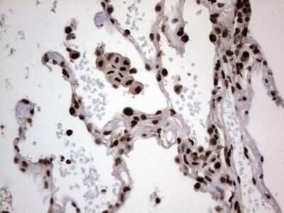 Immunohistochemistry: hnRNP L Antibody (OTI2E4) - Azide and BSA Free [NBP2-70908] - Analysis of Human lung tissue. (Heat-induced epitope retrieval by 1 mM EDTA in 10mM Tris, pH8.5, 120C for 3min)