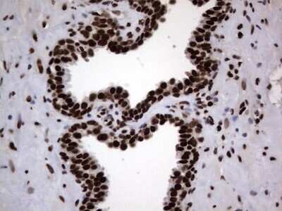 Immunohistochemistry: hnRNP L Antibody (OTI2E4) - Azide and BSA Free [NBP2-70908] - Analysis of Human prostate tissue. (Heat-induced epitope retrieval by 1 mM EDTA in 10mM Tris, pH8.5, 120C for 3min)