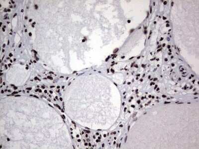 Immunohistochemistry: hnRNP L Antibody (OTI2E4) - Azide and BSA Free [NBP2-70908] - Analysis of Human thyroid tissue. (Heat-induced epitope retrieval by 1 mM EDTA in 10mM Tris, pH8.5, 120C for 3min)