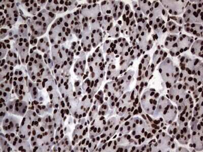 Immunohistochemistry: hnRNP L Antibody (OTI2E4) [NBP2-45990] - Analysis of Human pancreas. (Heat-induced epitope retrieval by 1 mM EDTA in 10mM Tris, pH8.5, 120C for 3min)