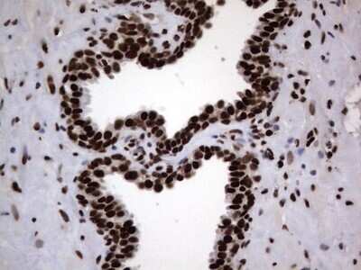 Immunohistochemistry: hnRNP L Antibody (OTI2E4) [NBP2-45990] - Analysis of Human prostate tissue. (Heat-induced epitope retrieval by 1 mM EDTA in 10mM Tris, pH8.5, 120C for 3min)