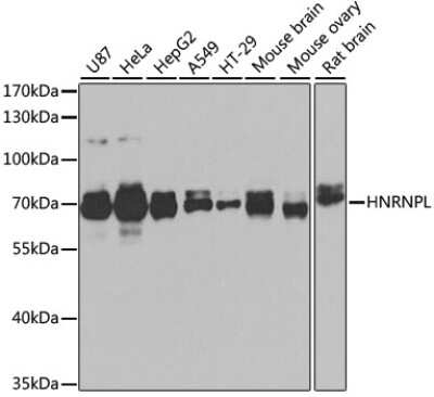 Western Blot: hnRNP L Antibody [NBP3-03640] - Analysis of extracts of various cell lines, using hnRNP L antibody at 1:1000 dilution. Secondary antibody: HRP Goat Anti-Rabbit IgG (H+L) at 1:10000 dilution. Lysates/proteins: 25ug per lane. Blocking buffer: 3% nonfat dry milk in TBST. Detection: ECL Basic Kit.