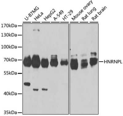 Western Blot: hnRNP L Antibody [NBP3-03641] - Analysis of extracts of various cell lines, using hnRNP L antibody at 1:1000 dilution. Secondary antibody: HRP Goat Anti-Rabbit IgG (H+L) at 1:10000 dilution. Lysates/proteins: 25ug per lane. Blocking buffer: 3% nonfat dry milk in TBST. Detection: ECL Enhanced Kit.