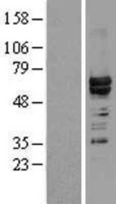 Western Blot: hnRNP L Overexpression Lysate (Adult Normal) [NBL1-11648] Left-Empty vector transfected control cell lysate (HEK293 cell lysate); Right -Over-expression Lysate for hnRNP L.