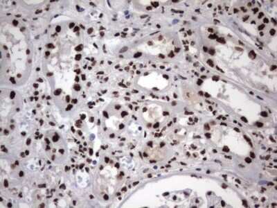 Immunohistochemistry: hnRNP M Antibody (4C9) [NBP2-45991] - Analysis of Human Kidney tissue. (Heat-induced epitope retrieval by 1 mM EDTA in 10mM Tris, pH8.5, 120C for 3min)