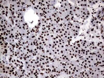 Immunohistochemistry: hnRNP M Antibody (4C9) [NBP2-45991] - Analysis of Human pancreas tissue. (Heat-induced epitope retrieval by 1 mM EDTA in 10mM Tris, pH8.5, 120C for 3min)