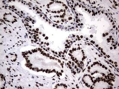 Immunohistochemistry: hnRNP M Antibody (4C9) [NBP2-45991] - Analysis of Human prostate tissue. (Heat-induced epitope retrieval by 1 mM EDTA in 10mM Tris, pH8.5, 120C for 3min)