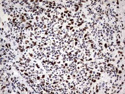 Immunohistochemistry: hnRNP M Antibody (4C9) [NBP2-45991] - Analysis of Human lymph node tissue. (Heat-induced epitope retrieval by 1 mM EDTA in 10mM Tris, pH8.5, 120C for 3min)