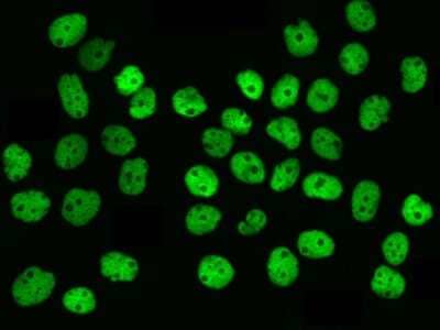 Immunocytochemistry/Immunofluorescence: hnRNP M Antibody [NBP2-97142] - Immunofluorescence staining of hnRNP M in A431 cells. Cells were fixed with 4% PFA, permeabilzed with 0.3% Triton X-100 in PBS, blocked with 10% serum, and incubated with rabbit anti-Human hnRNP M polyclonal antibody (dilution ratio 1:1000) at 4C overnight. Then cells were stained with the Alexa Fluor$488-conjugated Goat Anti-rabbit IgG secondary antibody (green). Positive staining was localized to nucleus.