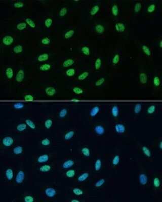 Immunocytochemistry/Immunofluorescence: hnRNP M Antibody [NBP3-03746] - Analysis of U-2 OS cells using hnRNP M antibody at dilution of 1:100. Blue: DAPI for nuclear staining.