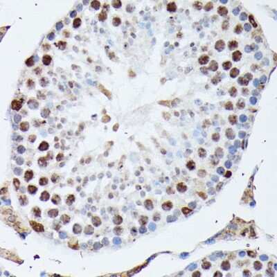 Immunohistochemistry-Paraffin: hnRNP M Antibody [NBP3-03746] - Paraffin-embedded mouse testis using hnRNP M antibody at dilution of 1:100 (40x lens).