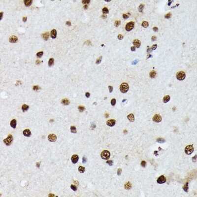 Immunohistochemistry-Paraffin: hnRNP M Antibody [NBP3-03746] - Paraffin-embedded rat brain using hnRNP M antibody at dilution of 1:100 (40x lens).