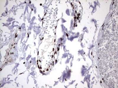 Immunohistochemistry: hnRNP M Antibody (OTI4C9) - Azide and BSA Free [NBP2-71200] - Analysis of Human colon tissue. (Heat-induced epitope retrieval by 1 mM EDTA in 10mM Tris, pH8.5, 120C for 3min)