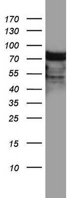 Western Blot: hnRNP M Antibody (OTI4C9) - Azide and BSA Free [NBP2-71200] - Analysis of A549 cell lysate (35ug).