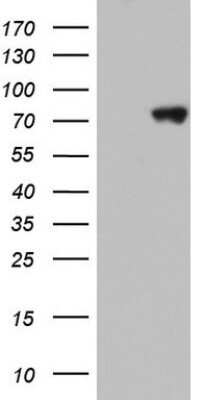 Western Blot: hnRNP M Antibody (OTI4C9) - Azide and BSA Free [NBP2-71200] - Analysis of HEK293T cells were transfected with the pCMV6-ENTRY control (Left lane) or pCMV6-ENTRY hnRNP M.