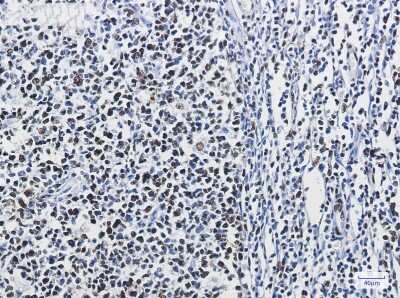 Immunohistochemistry-Paraffin: hnRNP M Antibody (S06-3B1) [NBP3-15042] - Immunohistochemistry of hnRNP M in paraffin-embedded Human tonsil using hnRNP M Rabbit mAb at dilution 1/50