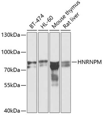 Western Blot: hnRNP M Antibody [NBP3-03746] - Analysis of extracts of various cell lines, using hnRNP M antibody at 1:1000 dilution. Secondary antibody: HRP Goat Anti-Rabbit IgG (H+L) at 1:10000 dilution. Lysates/proteins: 25ug per lane. Blocking buffer: 3% nonfat dry milk in TBST. Detection: ECL Basic Kit