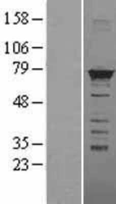 Western Blot: hnRNP M Overexpression Lysate (Adult Normal) [NBL1-11650] Left-Empty vector transfected control cell lysate (HEK293 cell lysate); Right -Over-expression Lysate for hnRNP M.