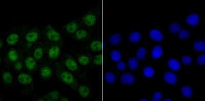 Immunocytochemistry/Immunofluorescence: hnRNP-Q Antibody (JG35-72) [NBP2-75527] - Staining hnRNP Q in LOVO cells (green). The nuclear counter stain is DAPI (blue). Cells were fixed in paraformaldehyde, permeabilised with 0.25% Triton X100/PBS.