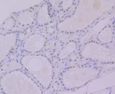 Immunohistochemistry-Paraffin: hnRNP-Q Antibody (JG35-72) [NBP2-75527] - Analysis of paraffin-embedded human thyroid gland tissue using anti-hnRNP Q antibody. Counter stained with hematoxylin.