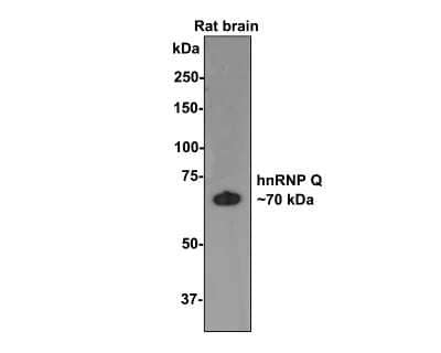 Western Blot: hnRNP-Q Antibody (JG35-72) [NBP2-75527] - Analysis of hnRNP Q on rat brain tissue lysates with Rabbit anti-hnRNP Q antibody at 1/500 dilution. Lysates/proteins at 20 ug/Lane. Predicted band size: 70 kDa Observed band size: 70 kDa Exposure time: 2 minutes; 8% SDS-PAGE gel. Proteins were transferred to a PVDF membrane and blocked with 5% NFDM/TBST for 1 hour at room temperature. The primary antibody at 1/500 dilution was used in 5% NFDM/TBST at room temperature for 2 hours. Goat Anti-Rabbit IgG - HRP Secondary Antibody at 1:200,000 dilution was used for 1 hour at room temperature.