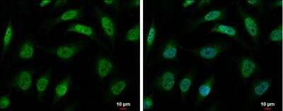 Immunocytochemistry/Immunofluorescence: hnRNP-R Antibody [NBP2-16868] -  HeLa cells were fixed in 4% paraformaldehyde at RT for 15 min. Green: hnRNP R protein stained by hnRNP R antibody [N1N2], N-term diluted at 1:500. Blue: Hoechst 33342 staining. Scale bar = 10 um.