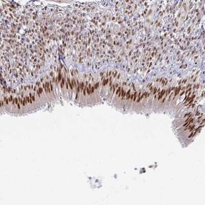 Immunohistochemistry: hnRNP U Antibody [NBP2-48729] - Staining of human bronchus shows strong nuclear positivity in respiratory epithelial cells.
