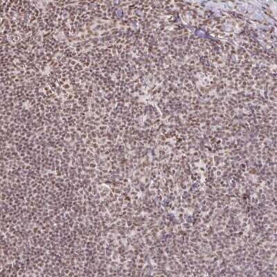 Immunohistochemistry: hnRNP U Antibody [NBP2-48729] - Staining of human lymph node shows strong nuclear positivity in non-germinal center cells.