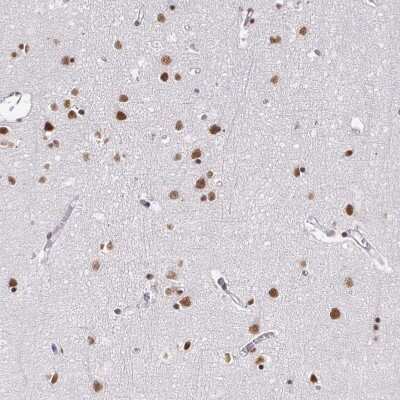Immunohistochemistry-Paraffin: hnRNP U Antibody [NBP2-48729] - Staining of human cerebral cortex shows strong nuclear positivity in neurons.
