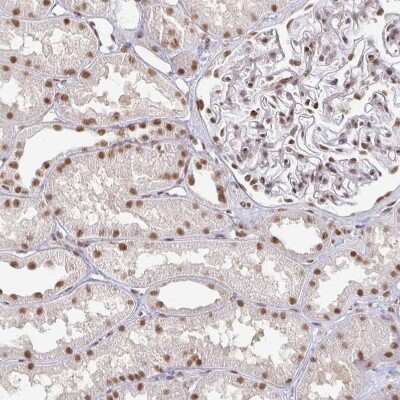 Immunohistochemistry-Paraffin: hnRNP U Antibody [NBP2-48729] - Staining of human kidney shows strong nuclear positivity in cells in tubules.