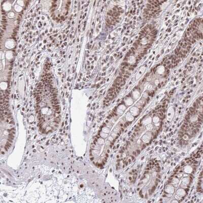 Immunohistochemistry-Paraffin: hnRNP U Antibody [NBP2-48729] - Staining of human small intestine shows strong nuclear positivity in glandular cells.