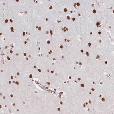Immunohistochemistry-Paraffin: hnRNP U Antibody [NBP2-49290] - Staining of human cerebral cortex shows strong nuclear positivity in neurons.