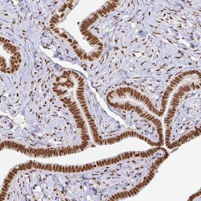 Immunohistochemistry-Paraffin: hnRNP U Antibody [NBP2-49290] - Staining of human Fallopian tube shows strong nuclear positivity in glandular cells.