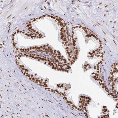 Immunohistochemistry-Paraffin: hnRNP U Antibody [NBP2-49290] - Staining of human prostate shows strong nuclear positivity in glandular cells.
