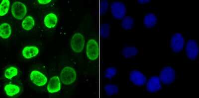 Immunocytochemistry/Immunofluorescence: hnRNP U Antibody (JB23-43) [NBP2-75526] - Staining HnRNP U in HepG2 cells (green). The nuclear counter stain is DAPI (blue). Cells were fixed in paraformaldehyde, permeabilised with 0.25% Triton X100/PBS.