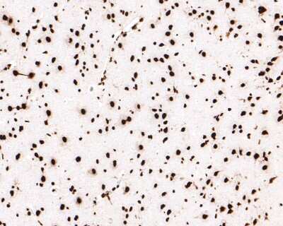 Immunohistochemistry-Paraffin: hnRNP U Antibody (JB23-43) [NBP2-75526] - Analysis of paraffin-embedded rat brain tissue with Rabbit anti-hnRNP U antibody washed with ddH2O and PBS, and then probed with the primary antibody  at 1/400 dilution for 1 hour at room temperature. The detection was performed using an HRP conjugated compact polymer system. DAB was used as the chromogen. Tissues were counterstained with hematoxylin and mounted with DPX.