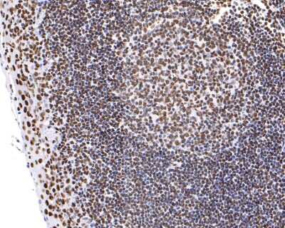 Immunohistochemistry-Paraffin: hnRNP U Antibody (JB23-43) [NBP2-75526] - Analysis of paraffin-embedded human tonsil tissue with Rabbit anti-hnRNP U antibody washed with ddH2O and PBS, and then probed with the primary antibody at 1/200 dilution for 1 hour at room temperature. The detection was performed using an HRP conjugated compact polymer system. DAB was used as the chromogen. Tissues were counterstained with hematoxylin and mounted with DPX.