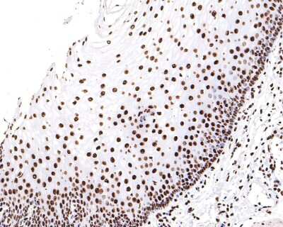 Immunohistochemistry-Paraffin: hnRNP U Antibody (JB23-43) [NBP2-75526] - Analysis of paraffin-embedded human esophagus tissue with Rabbit anti-hnRNP U antibody washed with ddH2O and PBS, and then probed with the primary antibody  at 1/200 dilution for 1 hour at room temperature. The detection was performed using an HRP conjugated compact polymer system. DAB was used as the chromogen. Tissues were counterstained with hematoxylin and mounted with DPX.