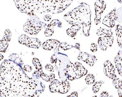 Immunohistochemistry-Paraffin: hnRNP U Antibody (JB23-43) [NBP2-75526] - Analysis of paraffin-embedded human placenta tissue with Rabbit anti-hnRNP U antibody washed with ddH2O and PBS, and then probed with the primary antibody  at 1/200 dilution for 1 hour at room temperature. The detection was performed using an HRP conjugated compact polymer system. DAB was used as the chromogen. Tissues were counterstained with hematoxylin and mounted with DPX.