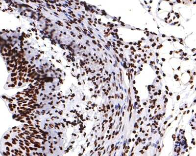 Immunohistochemistry-Paraffin: hnRNP U Antibody (JB23-43) [NBP2-75526] - Analysis of paraffin-embedded mouse bladder tissue with Rabbit anti-hnRNP U antibody washed with ddH2O and PBS, and then probed with the primary antibody  at 1/400 dilution for 1 hour at room temperature. The detection was performed using an HRP conjugated compact polymer system. DAB was used as the chromogen. Tissues were counterstained with hematoxylin and mounted with DPX.